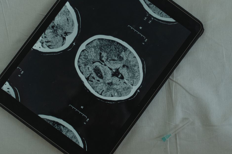 Secure transfer of medical images for telemedicine consultation