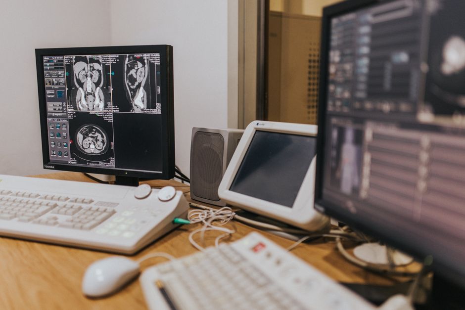 Radiologist analyzing CT scans on a computer monitor