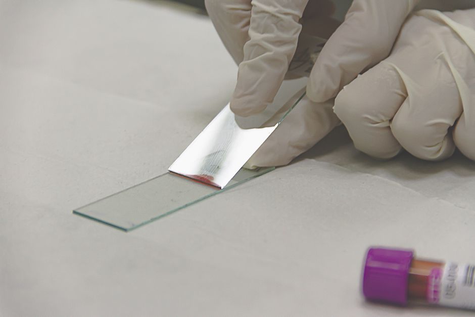 Pathology laboratory technician preparing sample for biopsy analysis