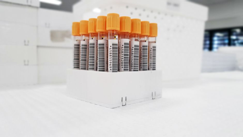 Blocks of paraffin prepared for pathology analysis
